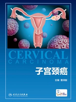 cover image of 子宫颈癌